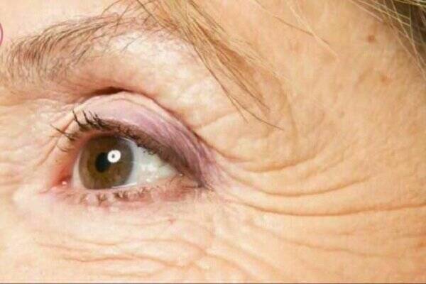 روش‌ های پیشگیری از پیری پوست بدن و صورت