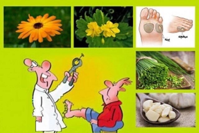 میخچه ضایعه‌ای پینه‌ای شکل است که بر اثر پوست مرده و معمولا در سطوح نازک و بدون موی پوست به‌ویژه در پشت پنجه پا یا انگشتان یا در قسمت‌های ضخیم‌تر پوست کف دست و پا به‌وجود می‌آید