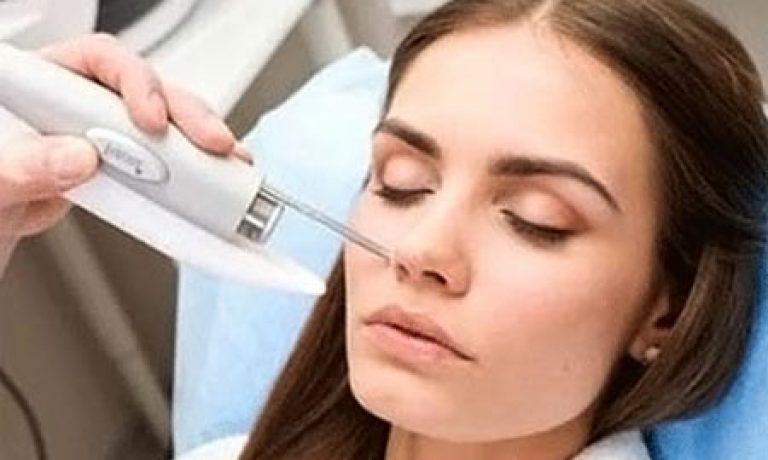 ر مقایسه با سایر روش‌های زیبایی و درمانی، برداشتن خال با لیزر باعث می‌شود بیماران کمتر دچار ترومای بعد از عمل شوند. این موضوع  به این دلیل است که نور لیزر، رنگدانه موجود در خال را از بین می‌برد، اما به طور مستقیم به پوست آسیب نمی‌رساند.