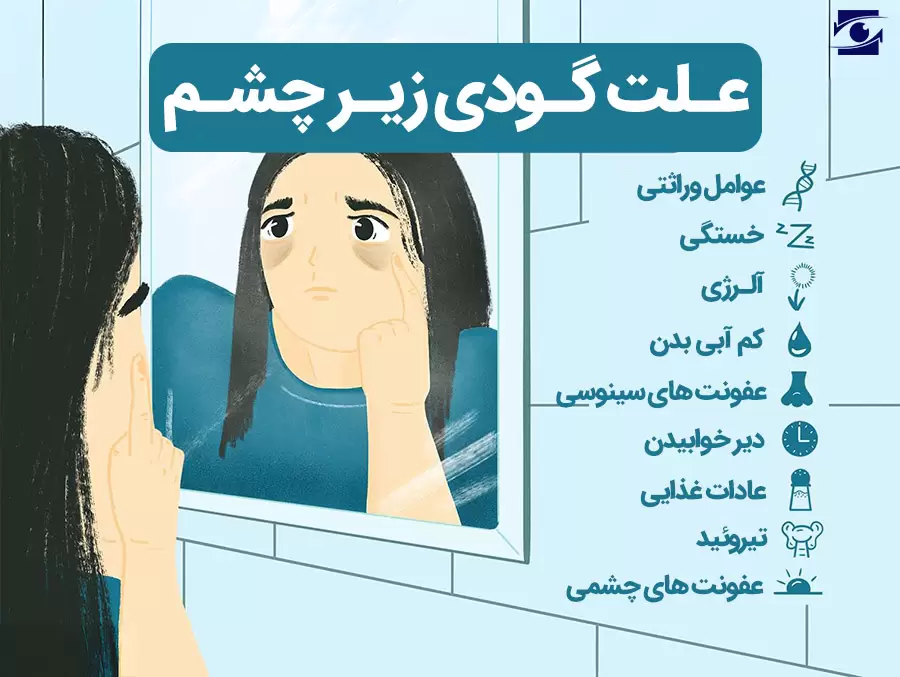 گودی چشم اغلب با سیاهی زیر چشم اشتباه گرفته می‌شود، زیرا هر دو در مکان مشابهی رخ می‌دهند. البته در اکثر موارد گودی چشم یک مشکل آرایشی و بی‌ضرر است، اما در موارد نادر می‌تواند به یک نگرانی پزشکی تبدیل شود. گودی پای چشم می‌تواند نشانه کهولت سن یا یک بیماری باشد و به صورت تورم خفیف یا پف ظاهر شود.
