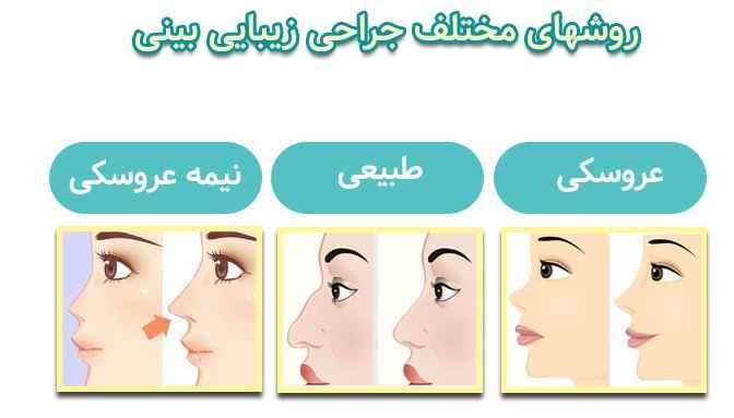 رینوپلاستی یا عمل زیبایی بینی: مزایا و معایب