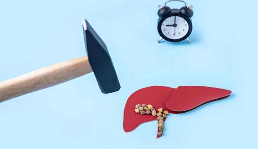 پیشگیری و درمان کبد چرب در طب سنتی
