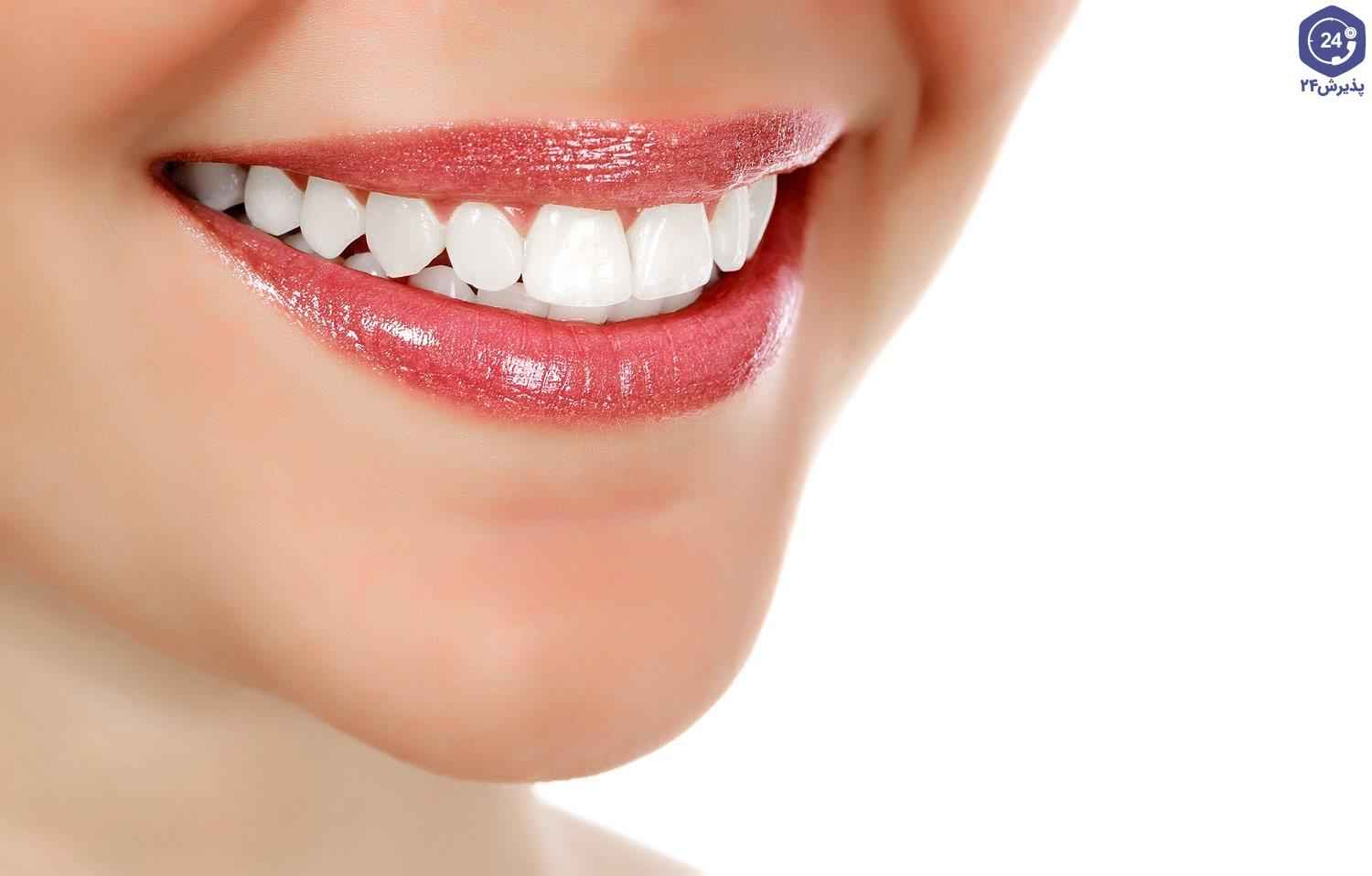 روش‌های سفید کردن دندان برای جذابیت لبخند