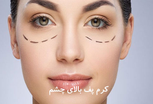پف بالای چشم معمولاً بی ضرر است، اما می تواند باعث ناراحتی و کاهش اعتماد به نفس شود. در برخی موارد، پف بالای چشم می تواند نشانه یک بیماری جدی باشد. اگر پف بالای چشم شما همراه با سایر علائم مانند درد، قرمزی یا ترشحات چشمی است، باید به پزشک مراجعه کنید.