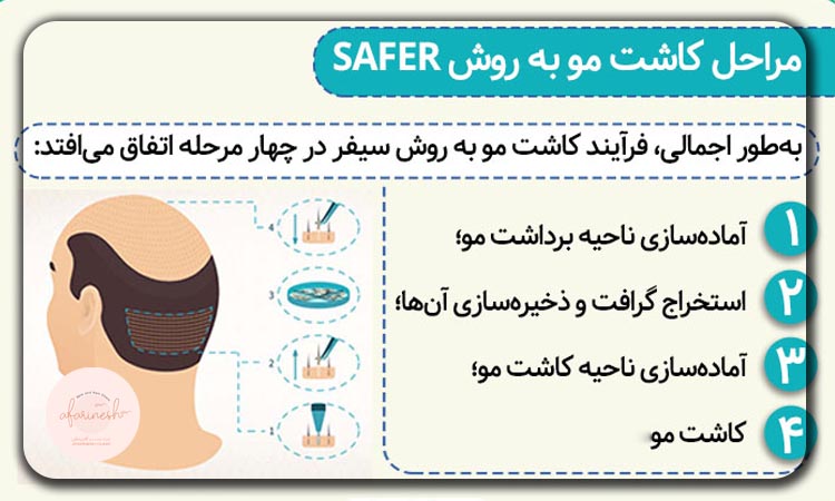 این روش امکان استفاده از بانک مو در نواحی مختلف سر و حتی بدن را نیز فراهم می‌کند، اما به‌طور معمول  برداشت از تاج سر انجام می‌شود. بسته به تراکم مو از نواحی پشت یا کنار سر یا بخش‌های دیگری چون ریش، سینه، کمر، ران یا بازوها نیز با نظر متخصص مو برداشته می‌شود.
