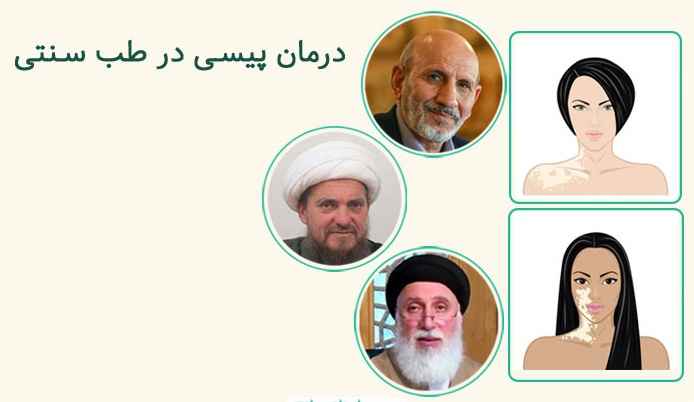 دکتر خیراندیش معتقد است که برص یا بیماری ویتیلیگو یک بیماری پوستی قابل درمان است که در طب سنتی به این بیماری بلور بلغم در سطح گفته می‌شود. این بیماری حتی اگر سراسر بدن را گرفته باشد، باز هم قابل درمان است.