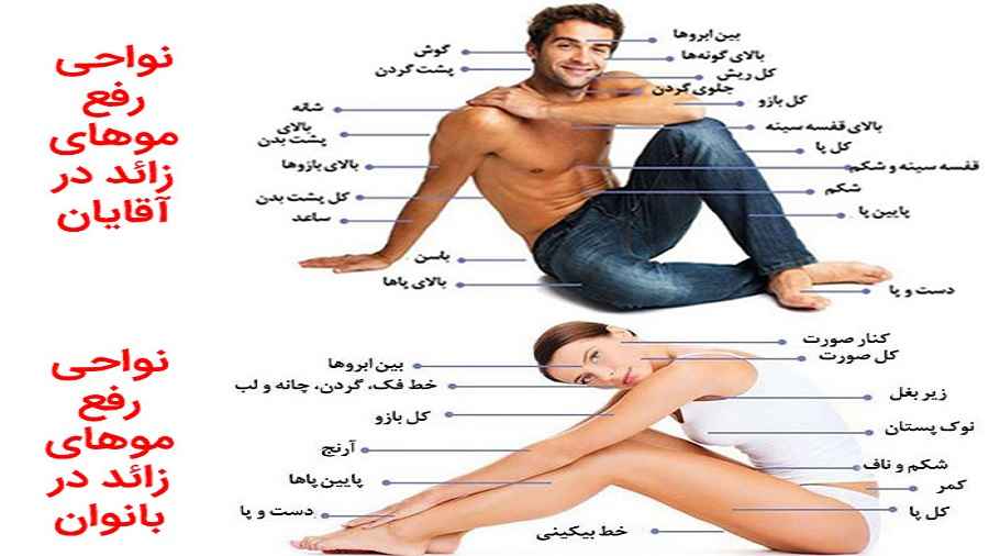 موهای زائد یک مشکل رایج برای بسیاری از افراد است. موهای زائد می تواند در هر قسمت از بدن رشد کند، اما معمولاً در صورت، زیر بغل، و پاها رشد می کند. موهای زائد می تواند باعث ناراحتی و اعتماد به نفس پایین شود.