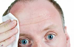 درمان تعریق زیاد سر و صورت