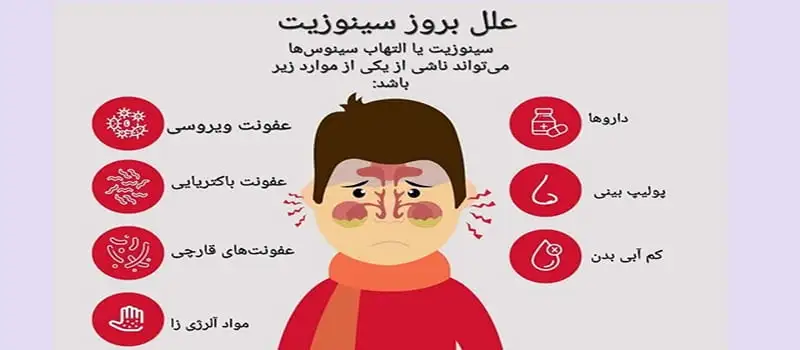 سینوزیت ممکن است ناشی از باکتری‌ها، ویروس‌ها یا قارچ‌ها اتفاق بیفتد و باعث تورم و مسدود شدن سینوس‌ها شود. شایع‌ترین علت عفونت سینوس‌ها شامل سرماخوردگی، آلرژی فصلی و رینیت آلرژیک، حساسیت به کپک، پولیپ بینی، انحراف تیغه‌ی بینی و ضعف سیستم ایمنی است.